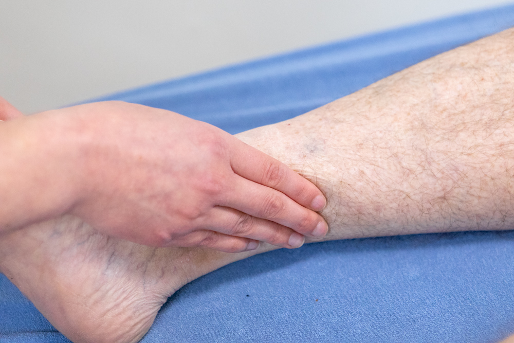 Onderzoek van het been bij oedeemfysiotherapie